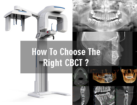 Treedental Topic: How to choose the right CBCT equipment for the dental clinic?