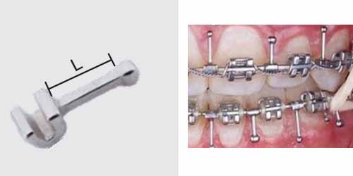 Movable Crimpable Hooks Adjustable for Dental Orthodontic