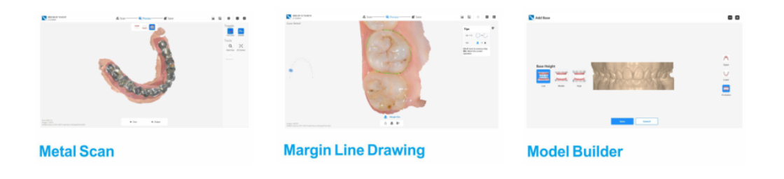 New 3D Dental Clinic Model Scanner Intraoral Oral Trade Handheld Digital Dental 3D Intraoral Scanner With Software,Digital Implant / Orthodontics / Restoration